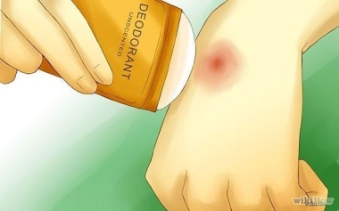 deoderant for itchiness